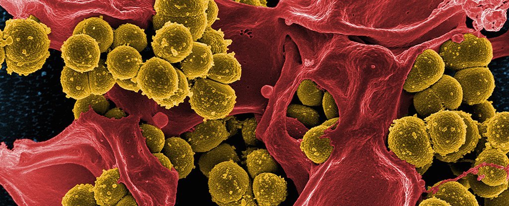 Altın, Antibiyotik Direncine Karşı Beklenmedik Gizli Silah Olabilir