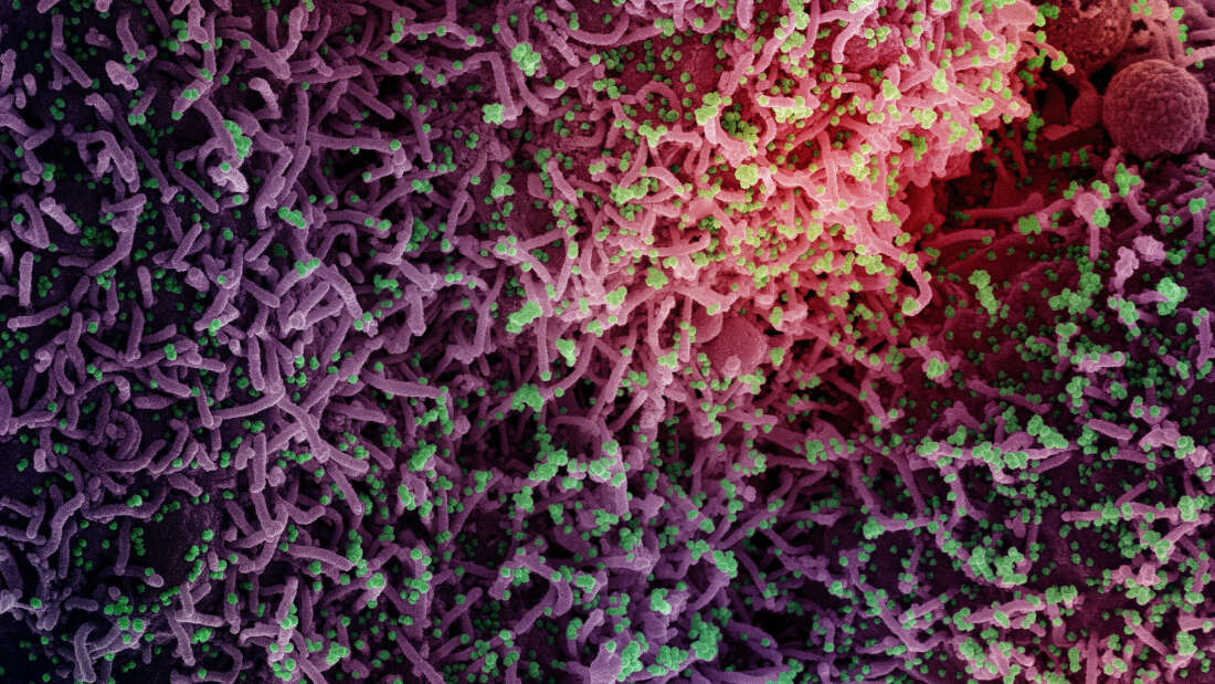 Soğuk Algınlığından T Hücreleri COVID-19'a Karşı Korunmaya Yardımcı Olabilir