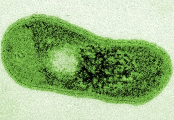 Gizemli Bir Çöl Bakterisi, Kendi Fotosentez Yeteneğini Geliştirdi