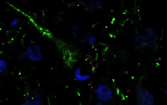 Bilim İnsanları Primatlar ve Primat Olmayanlar Arasındaki Şaşırtıcı Nöron Farklarını Buldu