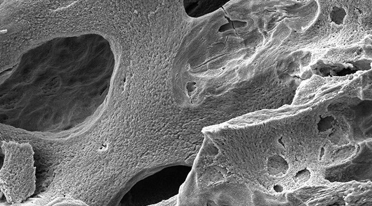 Yeni Çalışma, Uzayda Yaşamanın Astronot Kemikleri Üzerindeki Yıkıcı Etkisini Ortaya Çıkardı