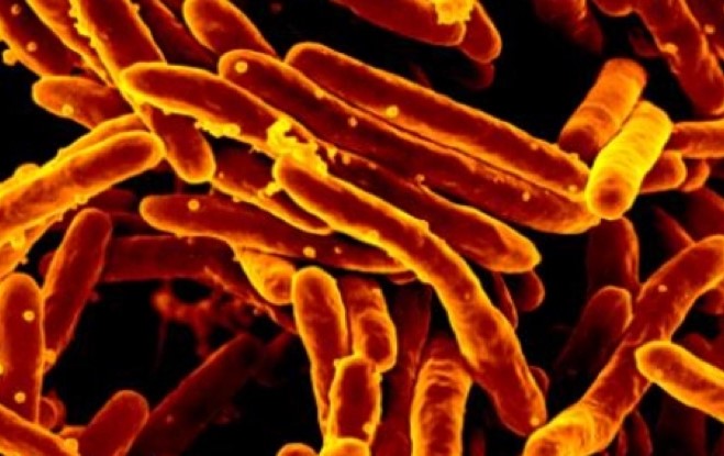 Tüberküloz Bakterilerinde Antibiyotik Direncinin Başladığı Keşfedildi