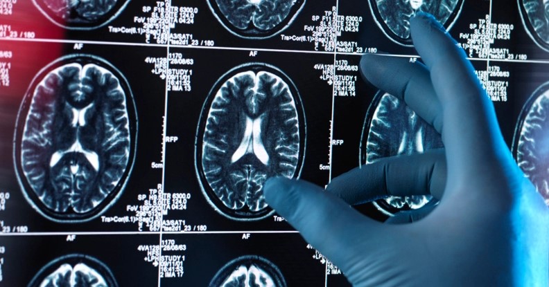 Yeni Bir Keşif Sayesinde, Parkinson Sadece 3 Dakikada Teşhis Edilebiliyor