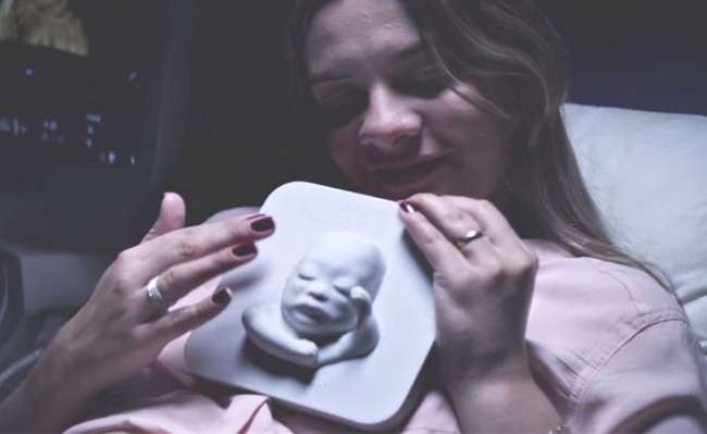 Görme Engelli Hamile Kadına Doğmamış Çocuğunun 3D Baskılı Yüzünü Çıkardılar