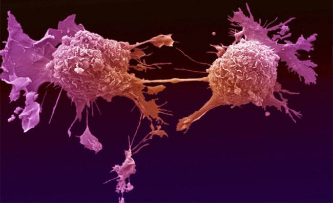 Kanserle Savaşta Yeni Umut: Salmonella Bakterisi