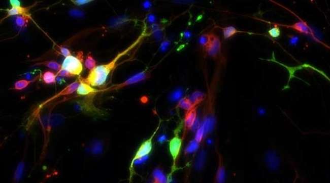 Laboratuvarda Serotonin Nöronları Geliştirildi