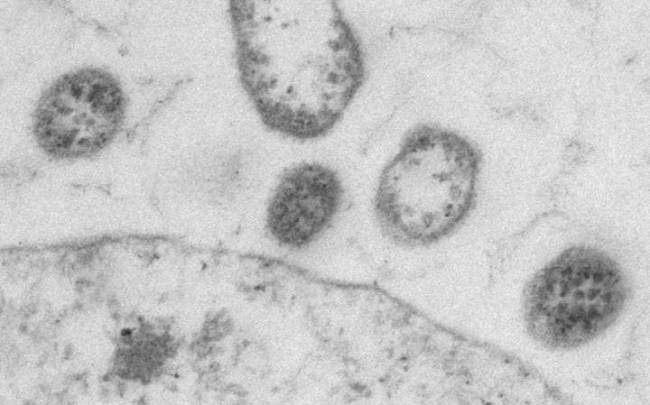“Tasarım Virüsler” Kansere Karşı Mücadele için Bağışıklık Sistemini Uyarıyor