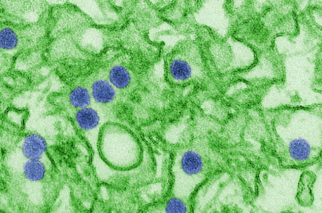 Zika Virüsü Beyin Hasarına Neden Oluyor